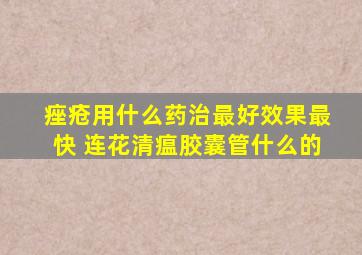 痤疮用什么药治最好效果最快 连花清瘟胶囊管什么的